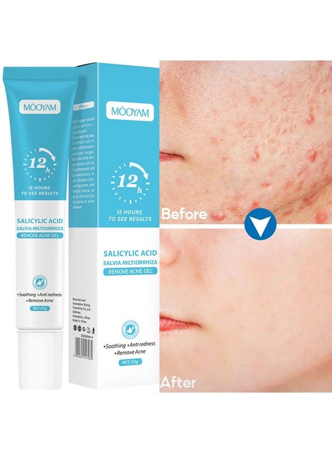 Salicylic Acid Remove Acne Gel, Rapid Action Acne Spot Treatment for Face Closure & Acne Dots, Premium Acne Scar Gel & Pimple Remover 20g