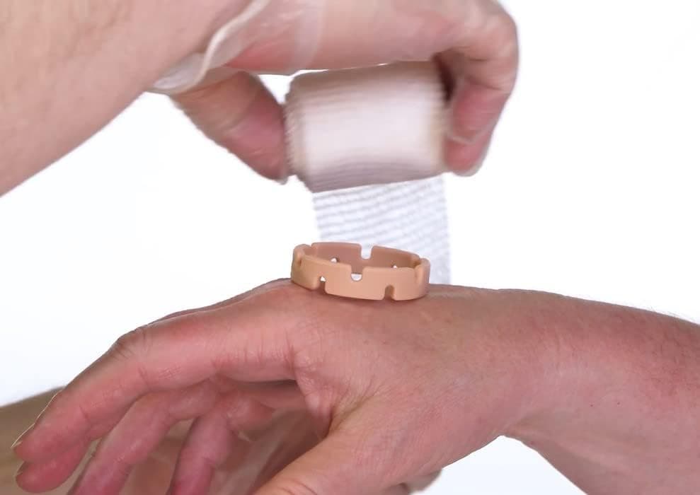 Jokari Healing Spacers 3 Pack for Small Scrapes Scratches or Burns Place Medical Grade Silicone Ring Around Affected Area Wrap With Bandage Secure With Tape to Allow for Airflow and Faster Healing