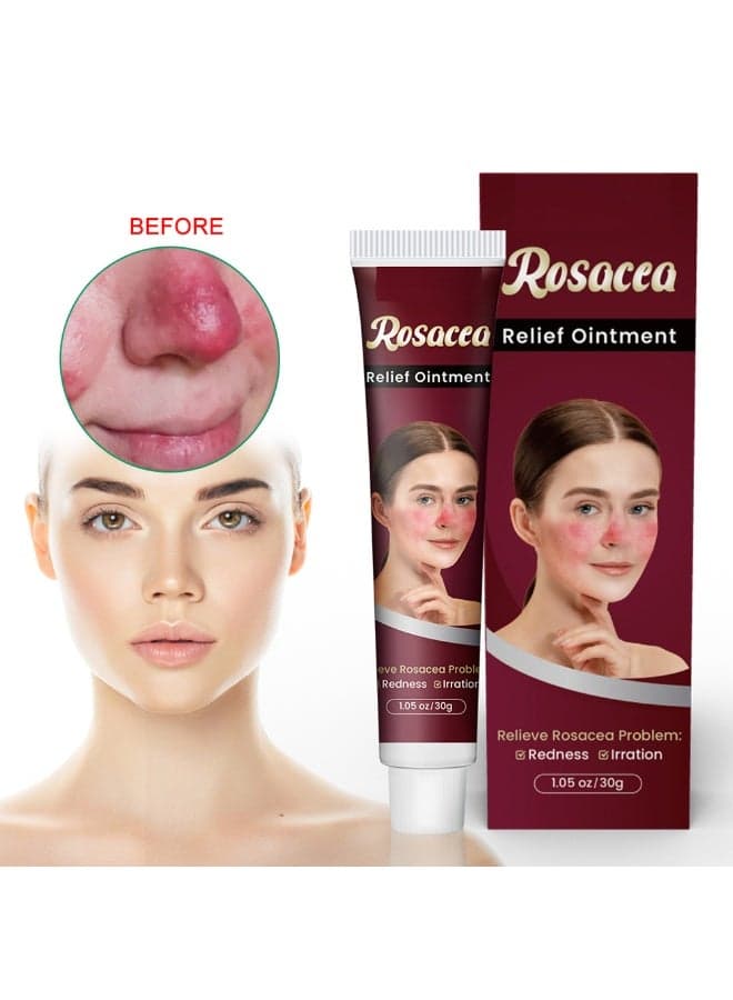 Rosacea Treatment Face Cream Red Nose Redness Relief Acne Cream 30g