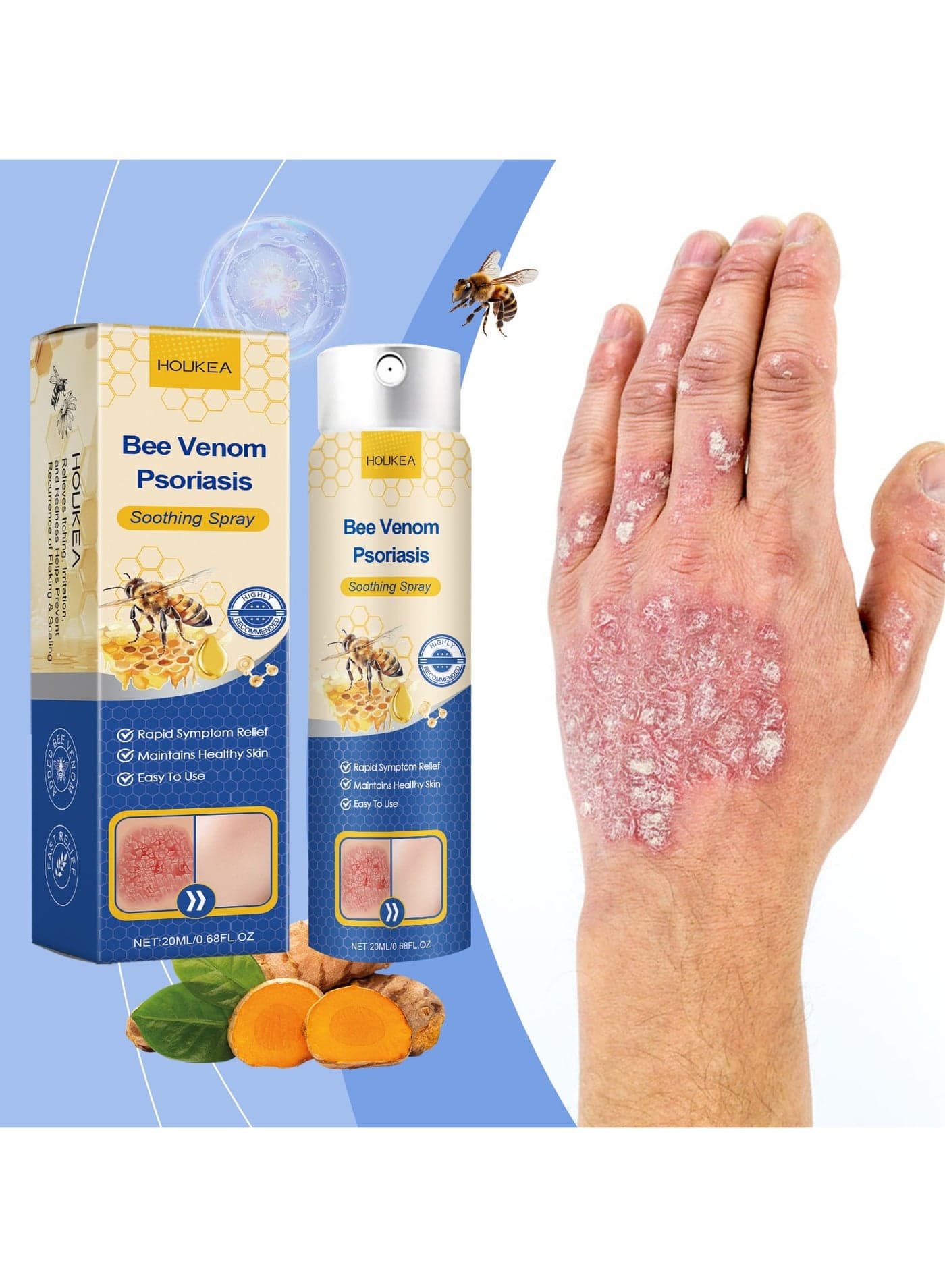 Bee Venom Psoriasis Treatment Spray, Psoriasis Treatment Spray, Bee Venom Treatment Spray, Psoriasis Treatment Spray, Bee Venom Psoriasis Spray (1 Piece)