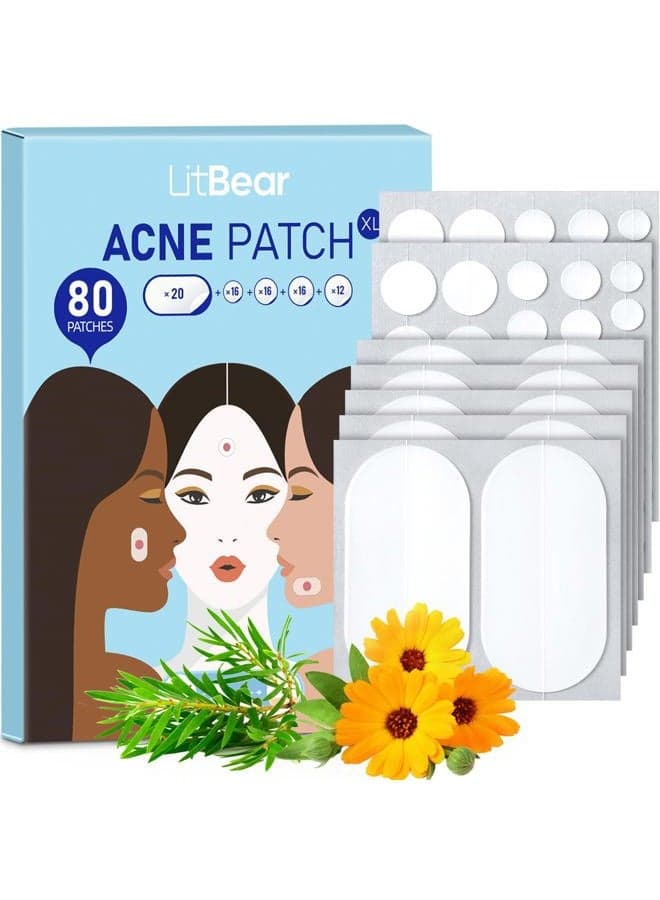 Large Acne Pimple Patches, 5 Sizes 80 Patches for Large Breakouts, Acne Patches for Face, Chin or Body, Acne Spot Patch with Tea Tree & Calendula Oil, Hydrocolloid Bandages for Acne Skin