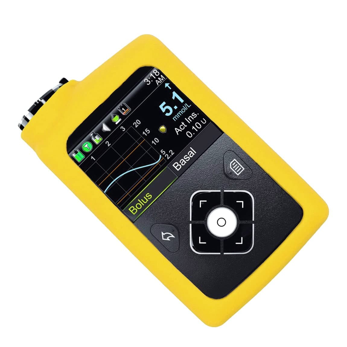 Solid Color Premium Silicone Soft Case for Medtronic Minimed Insulin Pump 630G 640G 670G770G780G Yellow