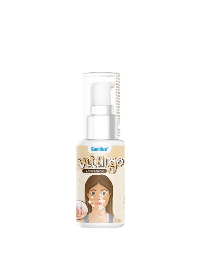 Sumifun Vitiligo Care Cream 30g Deep Skin Repair Pigment Care Moisturizer Gentle Fast Absorbing Formula for Bright Even Skin Tone Healthy Glow Daily Application
