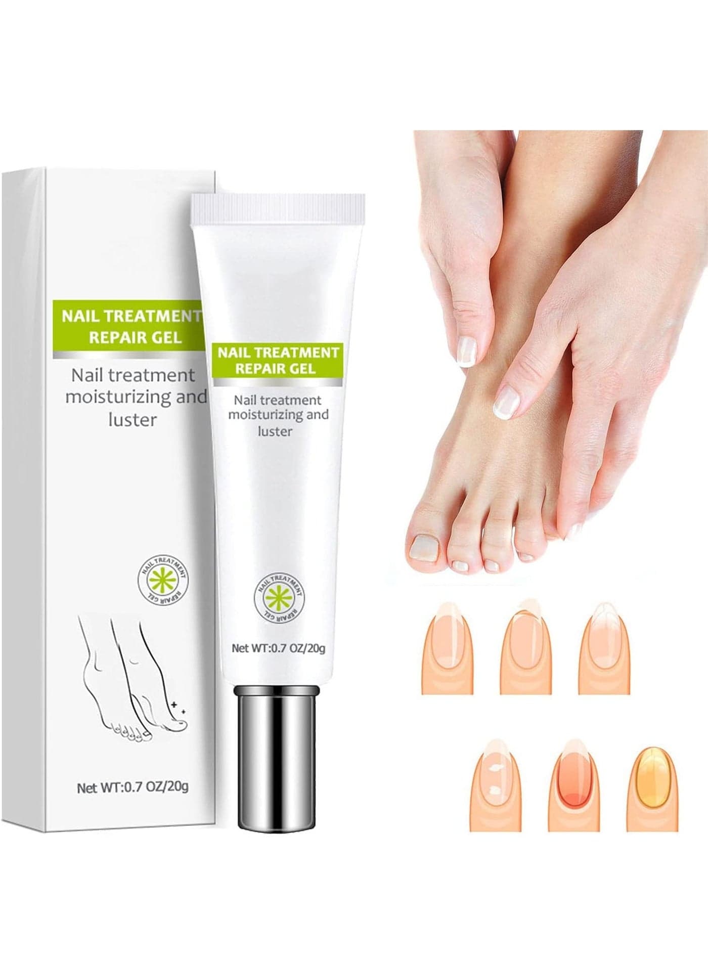 Nail Repair Gel Hand And Foot Onychomycosis Repair Soft Nail Thickening To Remove Onychomycosis Bright Nail Repair