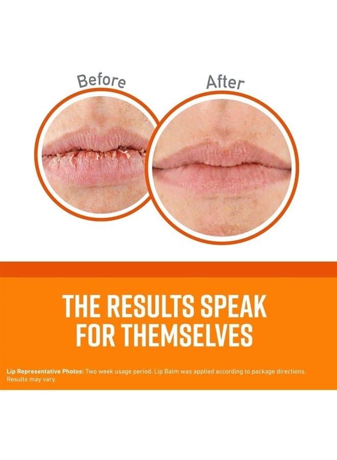 Unscented Lip Repair Lip Balm for Dry, Cracked Lips, Stick, (Pack of 5)