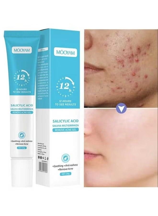Salicylic Acid Remove Acne Gel 20g, Rapid Action Acne Spot Treatment for Face Closure u0026 Acne Dots, Premium Acne Scar Gel u0026 Pimple Remover