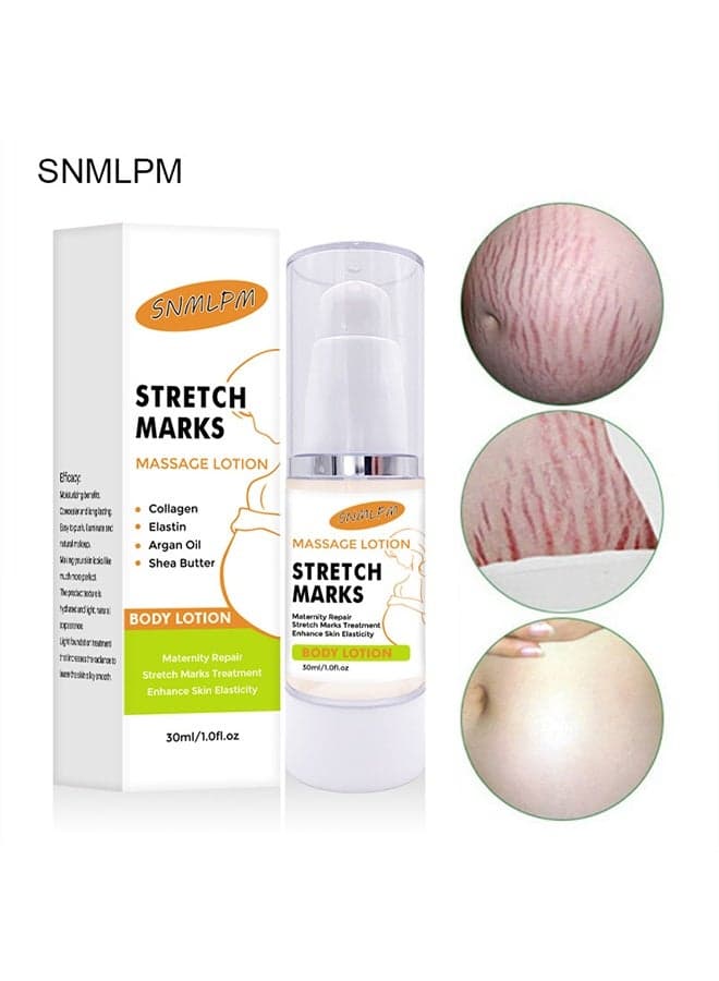 Stretch Marks Massage Lotion, Natural Plant Nutritional Glycerin Extract Formula, Stretch Mark Prevention, Old Scar Body Moisturizer, Tummy Butter For Stretch Marks To Firm Skin Moisturizer 30ml