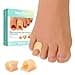 Welnove Hammertoe Corrector 6 Pack Toe Splints Soft Gel Toe Straighteners Realign Bent Curled Crooked Claw Hammer Toes Corrector for Men and Women Small Beige