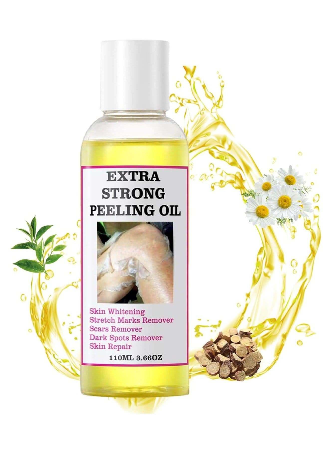 Yellow Peeling Oil,Skin Peeling Exfoliator,Skin Peeling Oil For Skin Lightening, Peeling Oil For Skin Brightening Moisturizing,Peeling Solution Exfoliatings Dark Skin For Body Lightening Bleaching