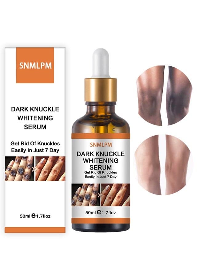Dark Knuckle Whitening Serum-7 days Treatment for Dark Spots in Hand and Feet Knuckles Exfoliating Improves Dullness Powerful Whitening Effect For Men and Women 50ml