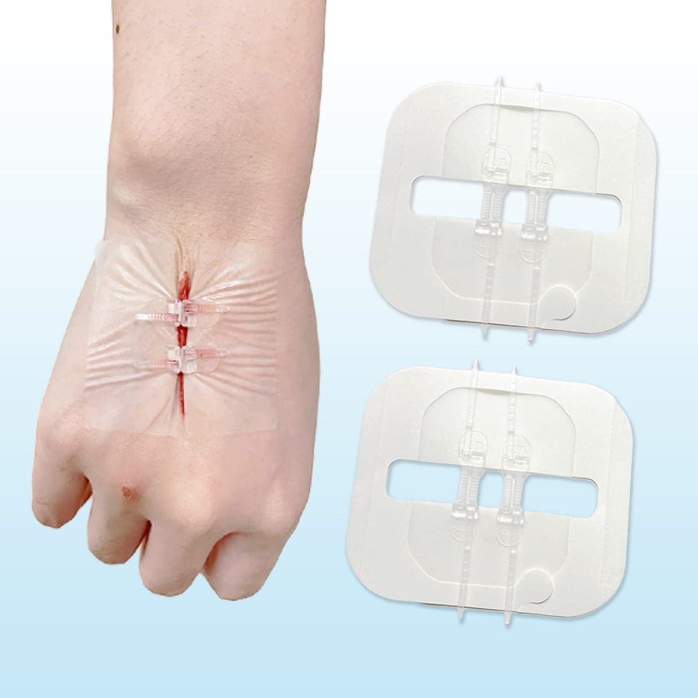 Mediss Emergency Wound Closures BandAid Adhesive BandagesZip Stitch Stickers for CampingSurvival and Household Gear2 PcsBoxPack of 1