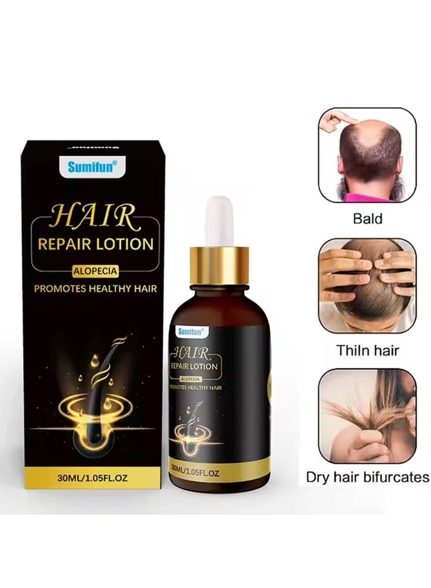 1PC 30ML Natural Organic Alopecia Hair Repair Lotion