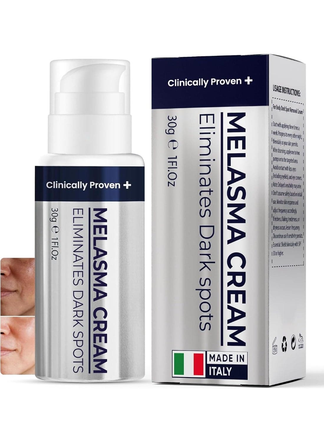 Cream & Age Spot Remover for Skin Discoloration, Post-Blemish Marks, Scars & Spots | Dark Spot Remover for Face & Body