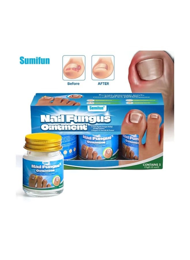 Advanced Anti-Fungal Nail Cream for Toenail and Fingernail Care with Visible Before and After Results, Helping Eliminate Infection, Restore Smooth Texture, and Support Long-Lasting Nail Health Easily at Home