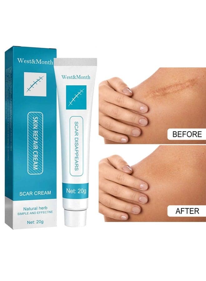 Scar repair cream,dilute hyperplasia pregnancy surgery burn scald skin repair scar cream 20g