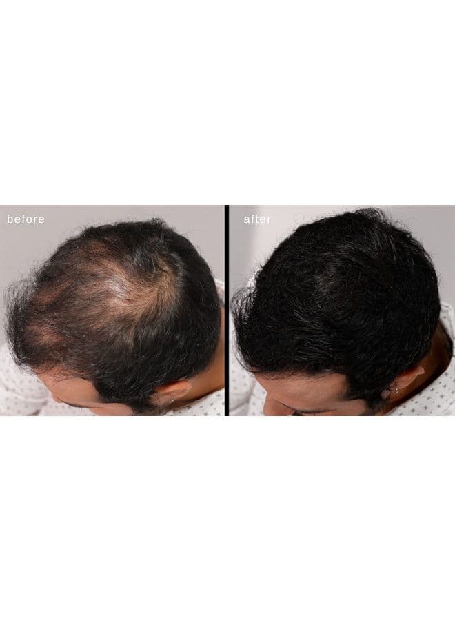 LUXE Hair Thickening Fibers - CONFIDENCE IN A JAR – 2 Months+ Supply! – Hypoallergenic, Dermatologist Tested – Multiple Colors Available (Gray)