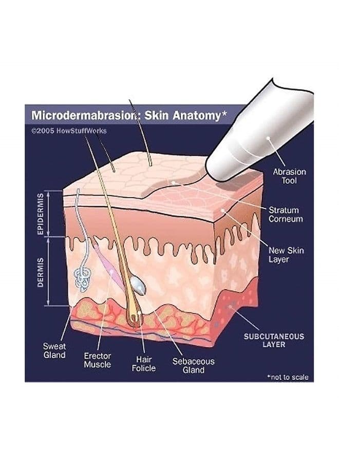 Microdermabrasion Crystals for Machines, All-Natural Facial Exfoliating Treatment for Dull or Dry Skin, Wrinkles, Blemishes, Scars & More (4 lb, 120 Grit)