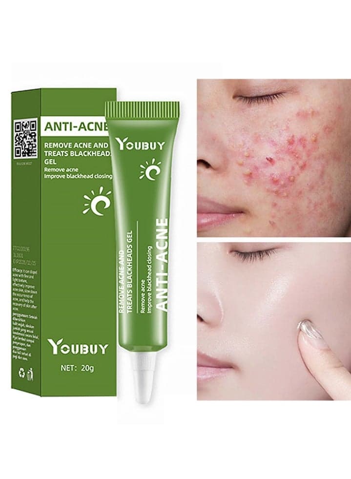 Anti-Acne Remove Acne and Treats Blackheads Gel-Day Use Remove Acne Pimple and Treats Blackhead with Azelaic Acid Oil Control Shrink Pores Redness Relief Skin Lightening Scar Fade Cream Acne Remover Cream 20g