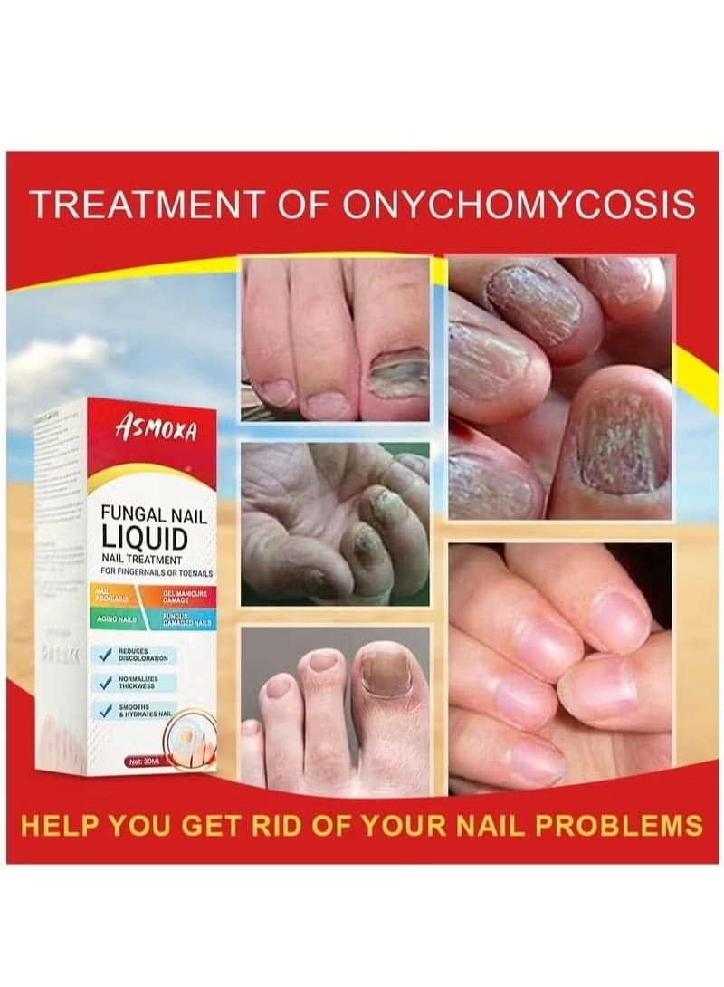 Fungal Nail Treatment Liquid Nail Fungus Treatment for Toenails & Fingernails Fungal Nail Renewal Anti Fungus Nail Repair Smooth & Hydrates Nail Reduce Discoloration 30ml
