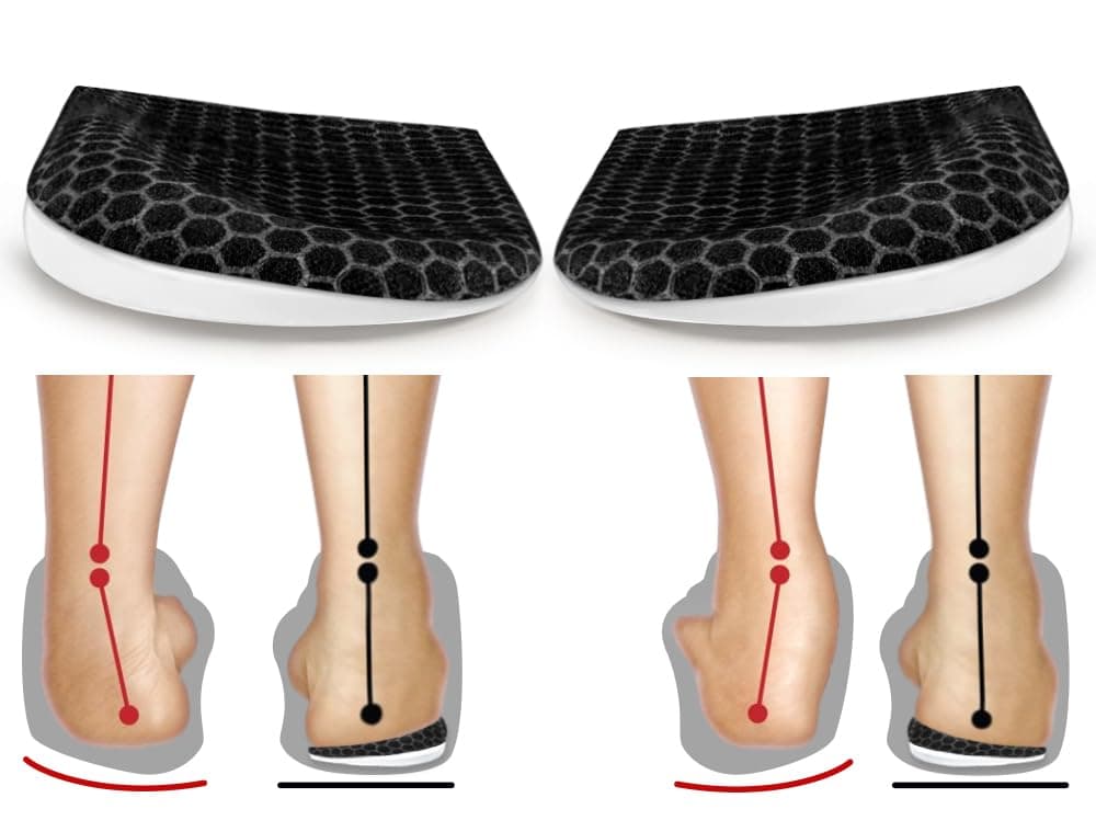 BIGGCOOL Corrective Insoles for Supination OverPronation Orthotics Medial Lateral Heel Wedge Inserts for Foot Alignment Bow Legs Knee Pain Black2 Layers L Women 812Men 7513