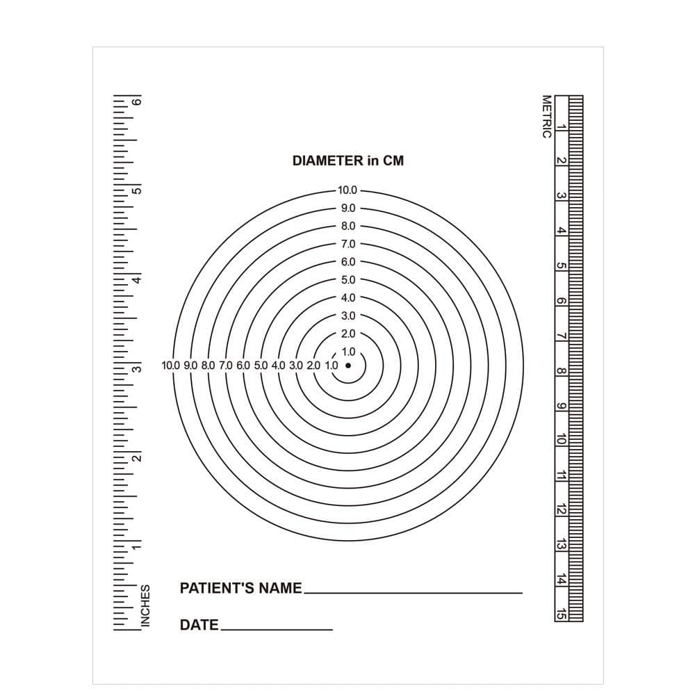 VAXATO Pack of 100 Wound Measurement Tools Wound Measuring Bullseye Guide Wound Measuring Ruler Medical Ruler Wound Measuring Tool Device Wound Measure Guide